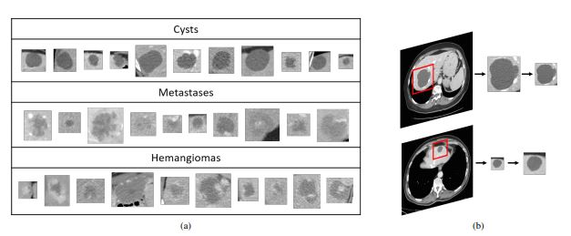 Application of GANs - Medical Image Augmentation